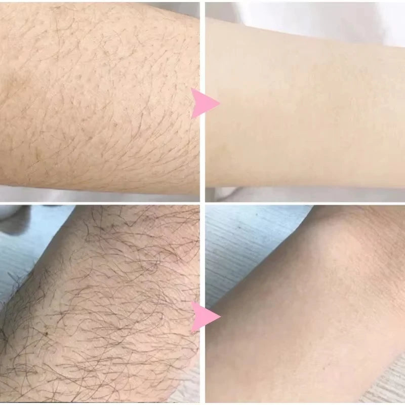 2 Minutes Fast Hair Removal Spray Painless Hair Growth Inhibitor Arm Armpit Leg Permanent Depilatory for Men Women Repair Care9*